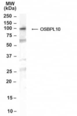 Western Blot OSBPL10 Antibody