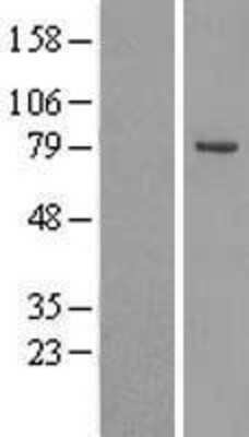 Western Blot: OSBPL10 Overexpression Lysate (Adult Normal) [NBL1-13985] Left-Empty vector transfected control cell lysate (HEK293 cell lysate); Right -Over-expression Lysate for OSBPL10.