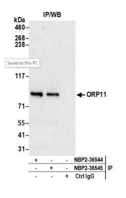 <b>Independent Antibodies Validation and Biological Strategies Validation.</b>Immunoprecipitation: OSBPL11 Antibody [NBP2-36545] - Detection of human ORP11 by western blot of immunoprecipitates. Samples: Whole cell lysate (0.5 or 1.0 mg per IP reaction; 20% of IP loaded) from 293T cells prepared using NETN lysis buffer. Antibodies: Affinity purified rabbit anti-ORP11 antibody NBP2-36545 used for IP at 6 ug per reaction. ORP11 was also immunoprecipitated by rabbit anti-ORP11 antibody NBP2-36544. For blotting immunoprecipitated ORP11, NBP2-36545 was used at 0.4 ug/ml. Detection: Chemiluminescence with an exposure time of 30 seconds.