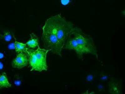 Immunocytochemistry/Immunofluorescence: OSBPL11 Antibody (OTI6A6) - Azide and BSA Free [NBP2-73160] - Staining of COS7 cells transiently transfected by pCMV6-ENTRY OSBPL11.