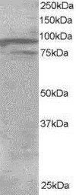 Western Blot OSBPL11 Antibody