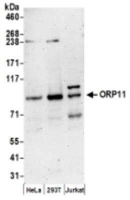 Western Blot: OSBPL11 Antibody [NBP2-36545] - Samples: Whole cell lysate (50 ug) from HeLa, 293T, and Jurkat cells prepared using NETN lysis buffer. Antibodies: Affinity purified rabbit antiORP11 antibody used for WB at  0.1 ug/ml. Detection: Chemiluminescence with an exposure  time of 3 minutes.