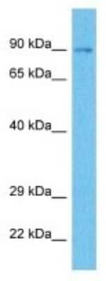 Western Blot: OSBPL11 Antibody [NBP3-10059] - Western blot analysis of OSBPL11 in Human Liver Tumor lysates. Antibody dilution at 1ug/ml