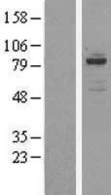 Western Blot: OSBPL11 Overexpression Lysate (Adult Normal) [NBL1-13986] Left-Empty vector transfected control cell lysate (HEK293 cell lysate); Right -Over-expression Lysate for OSBPL11.