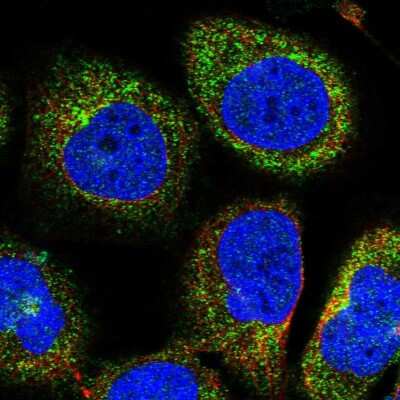 Immunocytochemistry/ Immunofluorescence OSBPL2 Antibody