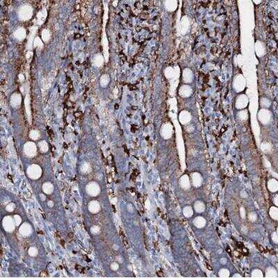 Immunohistochemistry-Paraffin OSBPL2 Antibody