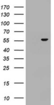 Western Blot: OSBPL2 Antibody (OTI2E6) - Azide and BSA Free [NBP2-73161] - Analysis of HEK293T cells were transfected with the pCMV6-ENTRY control (Left lane) or pCMV6-ENTRY OSBPL2.
