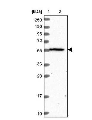 Western Blot OSBPL2 Antibody