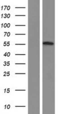 Western Blot: OSBPL2 Overexpression Lysate (Adult Normal) [NBP2-07264] Left-Empty vector transfected control cell lysate (HEK293 cell lysate); Right -Over-expression Lysate for OSBPL2.