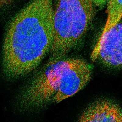 Immunocytochemistry/Immunofluorescence: OSBPL3 Antibody [NBP1-82968] - Immunofluorescent staining of human cell line A-431 shows localization to nucleoli & cytosol.