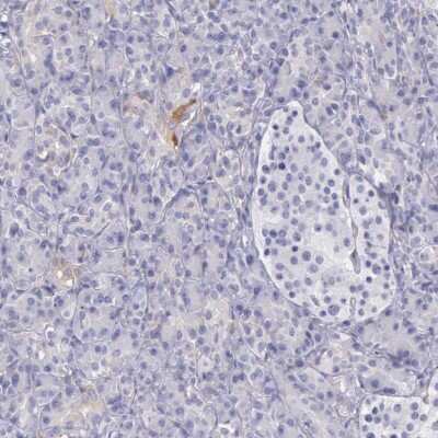 Immunohistochemistry-Paraffin OSBPL3 Antibody