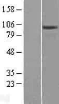 Western Blot: OSBPL3 Overexpression Lysate (Adult Normal) [NBL1-13988] Left-Empty vector transfected control cell lysate (HEK293 cell lysate); Right -Over-expression Lysate for OSBPL3.