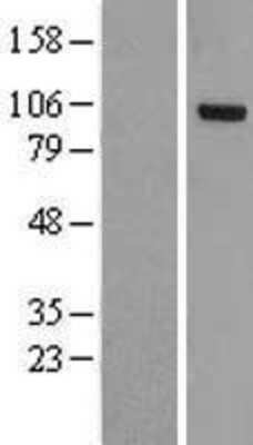 Western Blot: OSBPL3 Overexpression Lysate (Adult Normal) [NBL1-13989] Left-Empty vector transfected control cell lysate (HEK293 cell lysate); Right -Over-expression Lysate for OSBPL3.