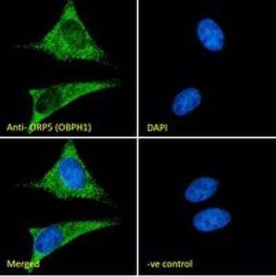 Immunocytochemistry/Immunofluorescence: OSBPL5 Antibody [NB100-57071] - Immunofluorescence analysis of paraformaldehyde fixed HeLa cells, permeabilized with 0.15% Triton. Primary incubation 1hr (10ug/ml) followed by Alexa Fluor 488 secondary antibody (2ug/ml), showing cytoplasmic staining. The nuclear stain is DAPI (blue). Negative control: Unimmunized goat IgG (10ug/ml) followed by Alexa Fluor 488 secondary antibody (2ug/ml).