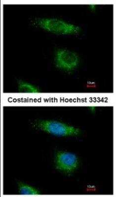 Immunocytochemistry/Immunofluorescence: OSBPL5 Antibody [NBP2-19638] - Immunofluorescence analysis of paraformaldehyde-fixed HeLa, using antibody at 1:500 dilution.
