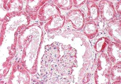 Immunohistochemistry-Paraffin OSBPL5 Antibody