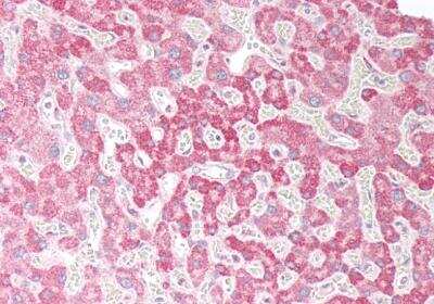 Immunohistochemistry-Paraffin OSBPL5 Antibody