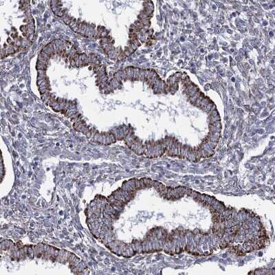Immunohistochemistry-Paraffin: OSBPL5 Antibody [NBP1-81403] - Staining of human endometrium shows strong granular cytoplasmic positivity in glandular cells.