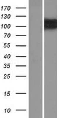 Western Blot: OSBPL5 Overexpression Lysate (Adult Normal) [NBP2-09706] Left-Empty vector transfected control cell lysate (HEK293 cell lysate); Right -Over-expression Lysate for OSBPL5.