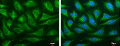 Immunocytochemistry/ Immunofluorescence OSBPL6 Antibody