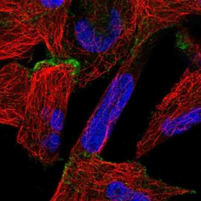 Immunocytochemistry/ Immunofluorescence OSBPL6 Antibody - BSA Free