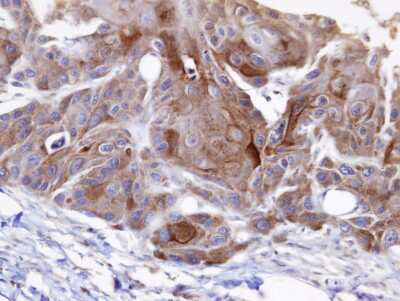 Immunohistochemistry-Paraffin OSBPL6 Antibody