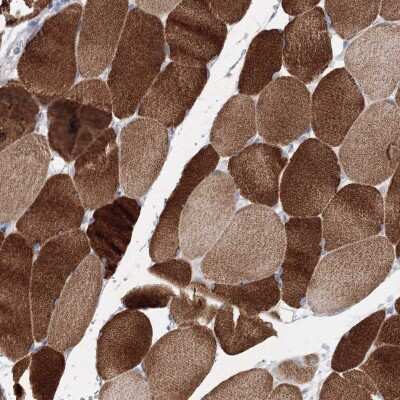 Immunohistochemistry-Paraffin: OSBPL6 Antibody [NBP1-82475] - Staining of human skeletal muscle shows high expression.