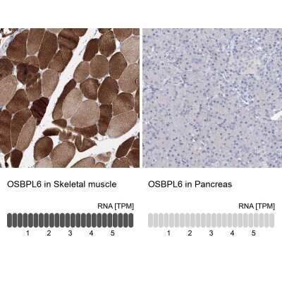 <b>Orthogonal Strategies Validation. </b>Immunohistochemistry-Paraffin: OSBPL6 Antibody [NBP1-82475] - Staining in human skeletal muscle and pancreas tissues using anti-OSBPL6 antibody. Corresponding OSBPL6 RNA-seq data are presented for the same tissues.