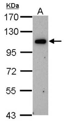 Western Blot OSBPL6 Antibody