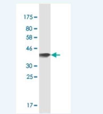 Western Blot: OSBPL7 Antibody (3D11) [H00114881-M03] - Detection against Immunogen (36.85 KDa). 