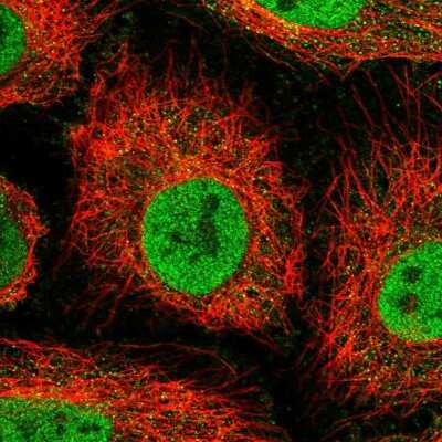 Immunocytochemistry/ Immunofluorescence OSBPL7 Antibody