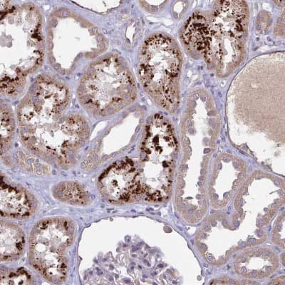 Immunohistochemistry OSBPL7 Antibody