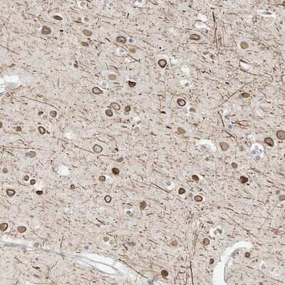 Immunohistochemistry-Paraffin: OSBPL7 Antibody [NBP1-81054] - Staining of human Cerebral cortex shows moderate membranous and cytoplasmic positivity in neuronal and glial cells.