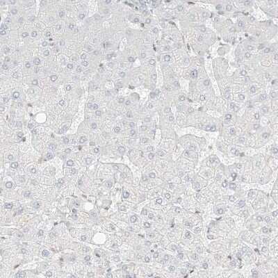 Immunohistochemistry-Paraffin: OSBPL7 Antibody [NBP1-81054] - Staining of human Liver shows no positivity in hepatocytes as expected.