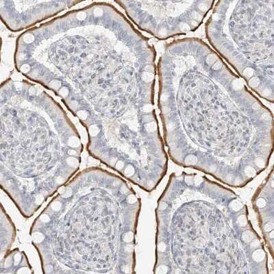 Immunohistochemistry-Paraffin: OSBPL7 Antibody [NBP1-81054] - Staining of human Small intestine shows moderate membranous positivity in glandular cells.