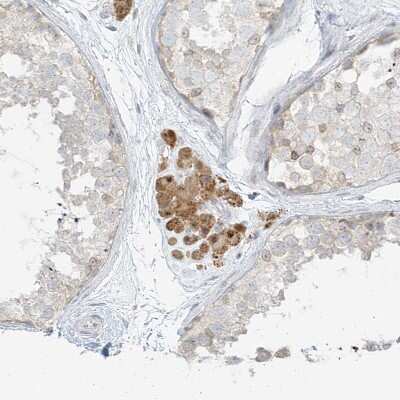 Immunohistochemistry-Paraffin: OSBPL7 Antibody [NBP1-81054] - Staining of human Testis shows moderate cytoplasmic positivity in Leydig cells.