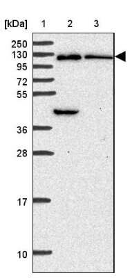 Western Blot OSBPL7 Antibody