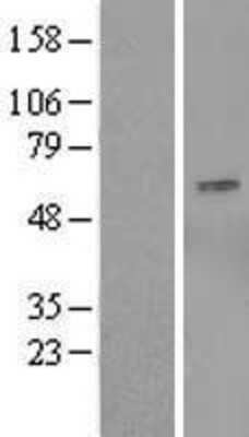 Western Blot: OSBPL9 Overexpression Lysate (Adult Normal) [NBL1-13995] Left-Empty vector transfected control cell lysate (HEK293 cell lysate); Right -Over-expression Lysate for OSBPL9.