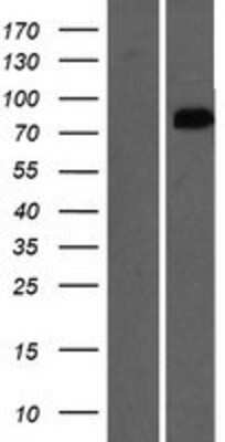 Western Blot: OSBPL9 Overexpression Lysate (Adult Normal) [NBP2-05430] Left-Empty vector transfected control cell lysate (HEK293 cell lysate); Right -Over-expression Lysate for OSBPL9.