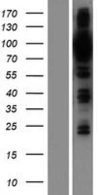 Western Blot: OSBPL9 Overexpression Lysate (Adult Normal) [NBP2-05431] Left-Empty vector transfected control cell lysate (HEK293 cell lysate); Right -Over-expression Lysate for OSBPL9.