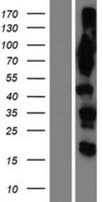 Western Blot: OSBPL9 Overexpression Lysate (Adult Normal) [NBP2-05432] Left-Empty vector transfected control cell lysate (HEK293 cell lysate); Right -Over-expression Lysate for OSBPL9.