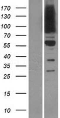 Western Blot: OSBPL9 Overexpression Lysate (Adult Normal) [NBP2-05433] Left-Empty vector transfected control cell lysate (HEK293 cell lysate); Right -Over-expression Lysate for OSBPL9.