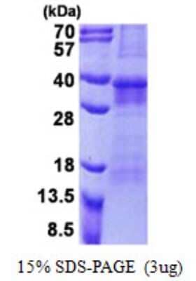 SDS-Page: Recombinant Human OSCAR His Protein [NBP2-23312] - 3ug by SDS-PAGE under reducing condition and visualized by coomassie blue stain.