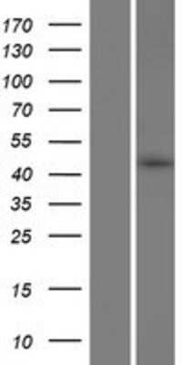 Western Blot: NOR1/OSCP1 Overexpression Lysate (Native) [NBP2-05510] - Left-Empty vector transfected control cell lysate (HEK293 cell lysate); Right -Over-expression Lysate for NOR1/OSCP1.