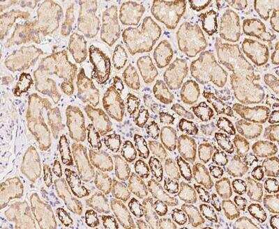 Immunohistochemistry-Paraffin: OSER1 Antibody [NBP3-12611] - Staining of human C20orf111 in human kidney with rabbit polyclonal antibody at 1:2000 dilution.