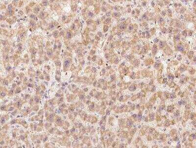 Immunohistochemistry-Paraffin: OSER1 Antibody [NBP3-12611] -  Staining of human C20orf111 in human liver with rabbit polyclonal antibody at 1:2000 dilution.