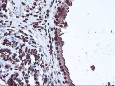 Immunohistochemistry-Paraffin: OSGEP Antibody (9E3) [NBP2-00823] - Staining of paraffin-embedded Human breast tissue using anti-OSGEP mouse monoclonal antibody.