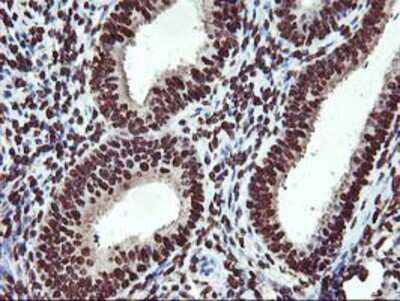 Immunohistochemistry-Paraffin: OSGEP Antibody (9E3) [NBP2-00823] - Staining of paraffin-embedded Human endometrium tissue using anti-OSGEP mouse monoclonal antibody.