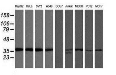 Western Blot: OSGEP Antibody (9E3) [NBP2-00823] Analysis of extracts (35ug) from 9 different cell lines by using anti-OSGEP monoclonal antibody.