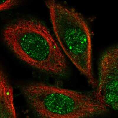 Immunocytochemistry/Immunofluorescence: OSGEP Antibody [NBP1-83378] - Staining of human cell line PC-3 shows localization to nucleoplasm, nuclear speckles & plasma membrane.